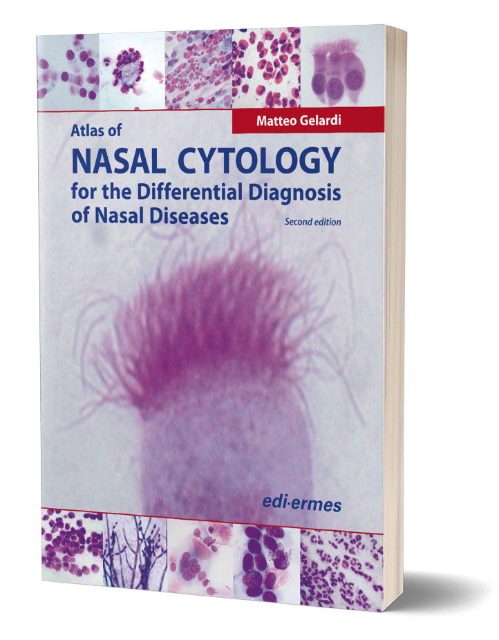 Atlas of nasal cytology